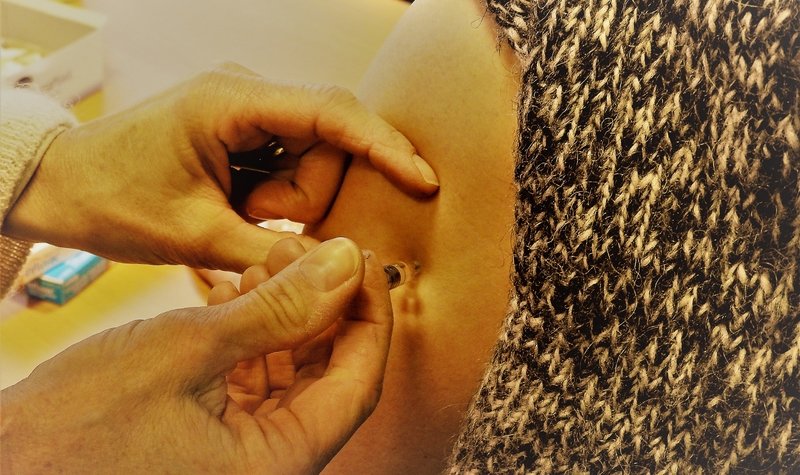 Hundrað ár frá spænsku veikinni