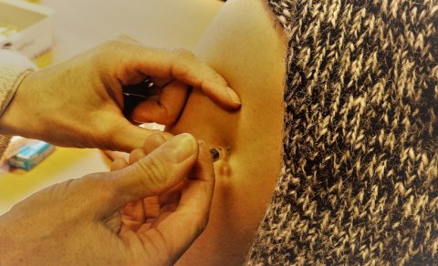 Hundrað ár frá spænsku veikinni